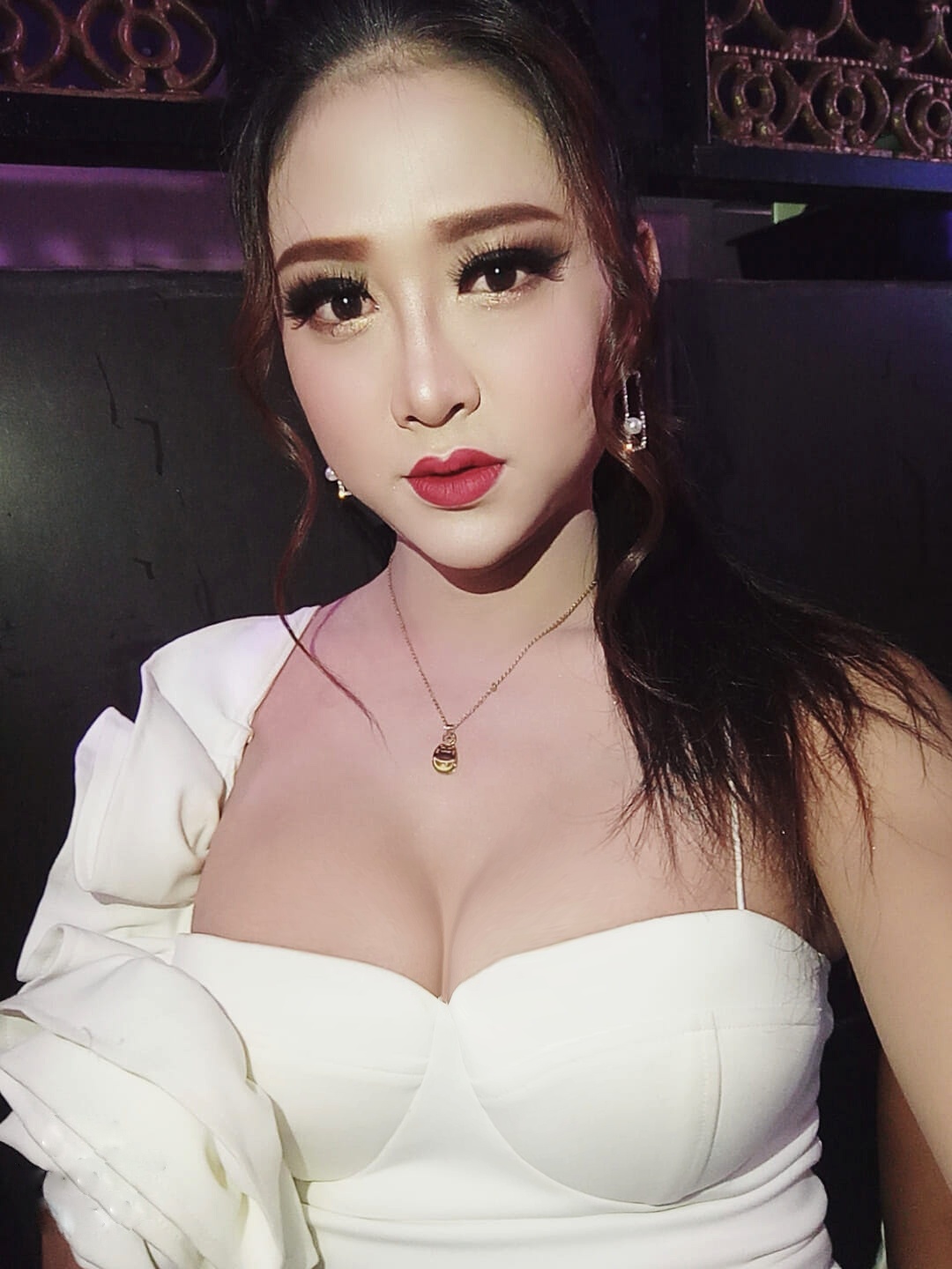 Bệnh viện Thẩm mỹ JW Hàn Quốc ảnh 5 Benh vien Tham my JW Han Quoc anh 5