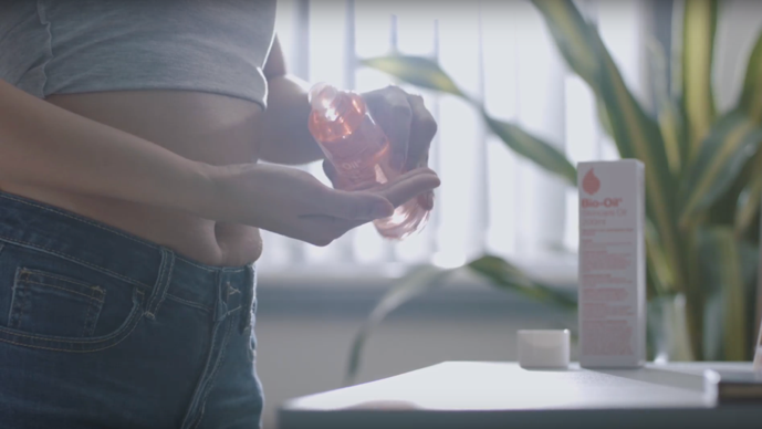 vết rạn da,  sẹo tâm lý ảnh 4 vet ran da,  seo tam ly anh 4