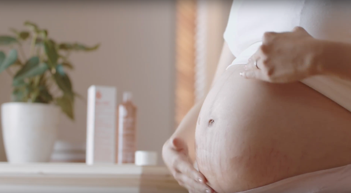 vết rạn da,  sẹo tâm lý ảnh 3 vet ran da,  seo tam ly anh 3