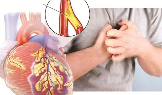 Mau nhiem mo dan den nhung bien chung nguy hiem nao? hinh anh