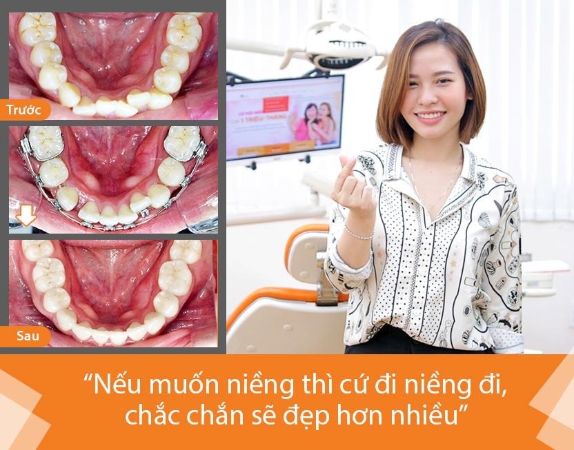 Up Dental anh 1