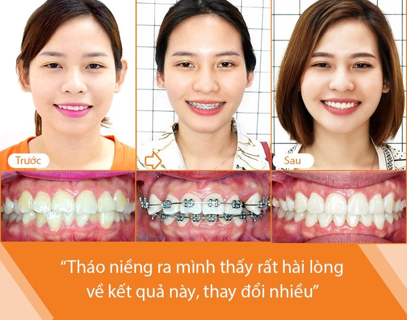 Up Dental anh 2
