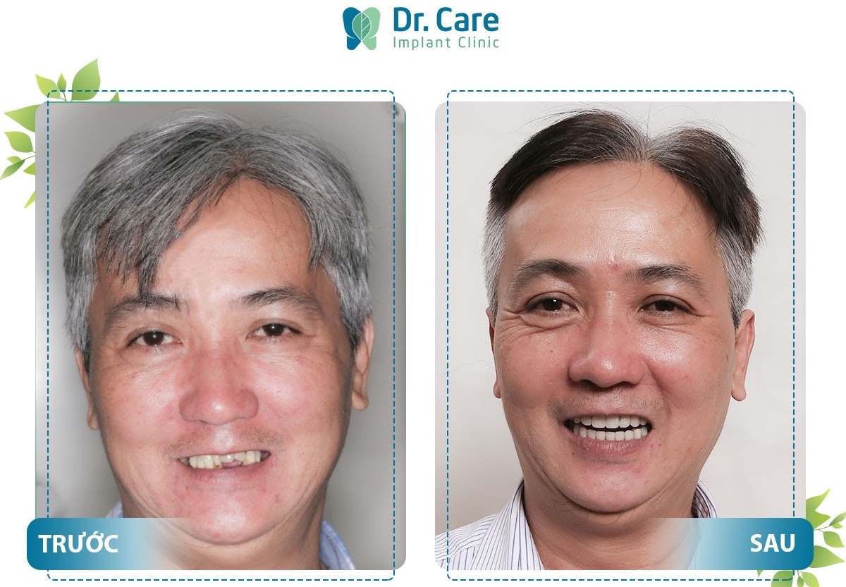 Dr. Care anh 2