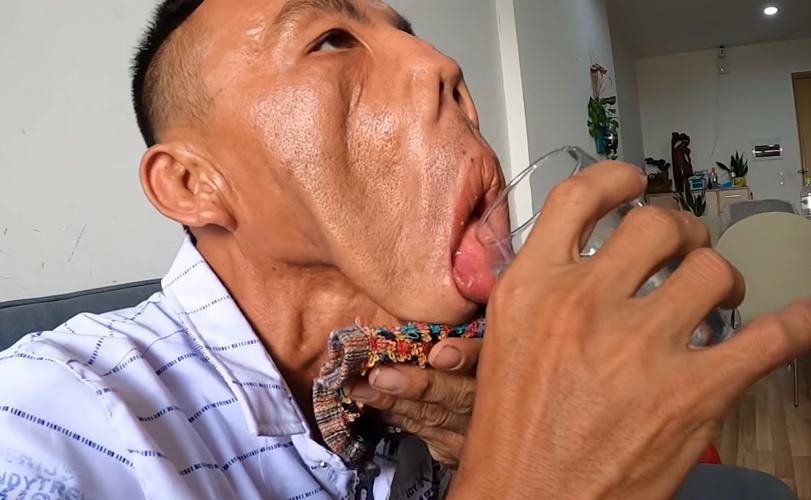 JW  ảnh 1 JW anh 1
