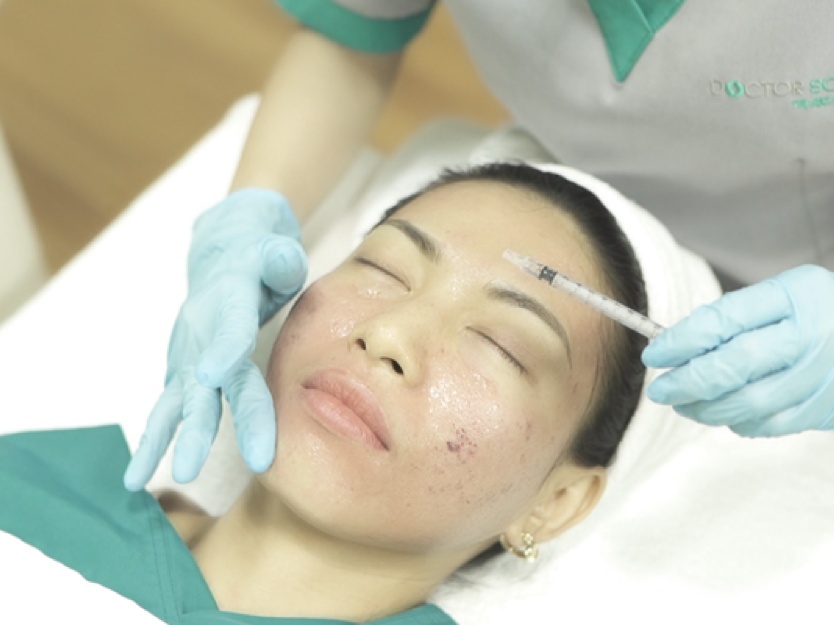 Phuong phap '4 trong 1' giup khac phuc seo ro tai Doctor Scar hinh anh