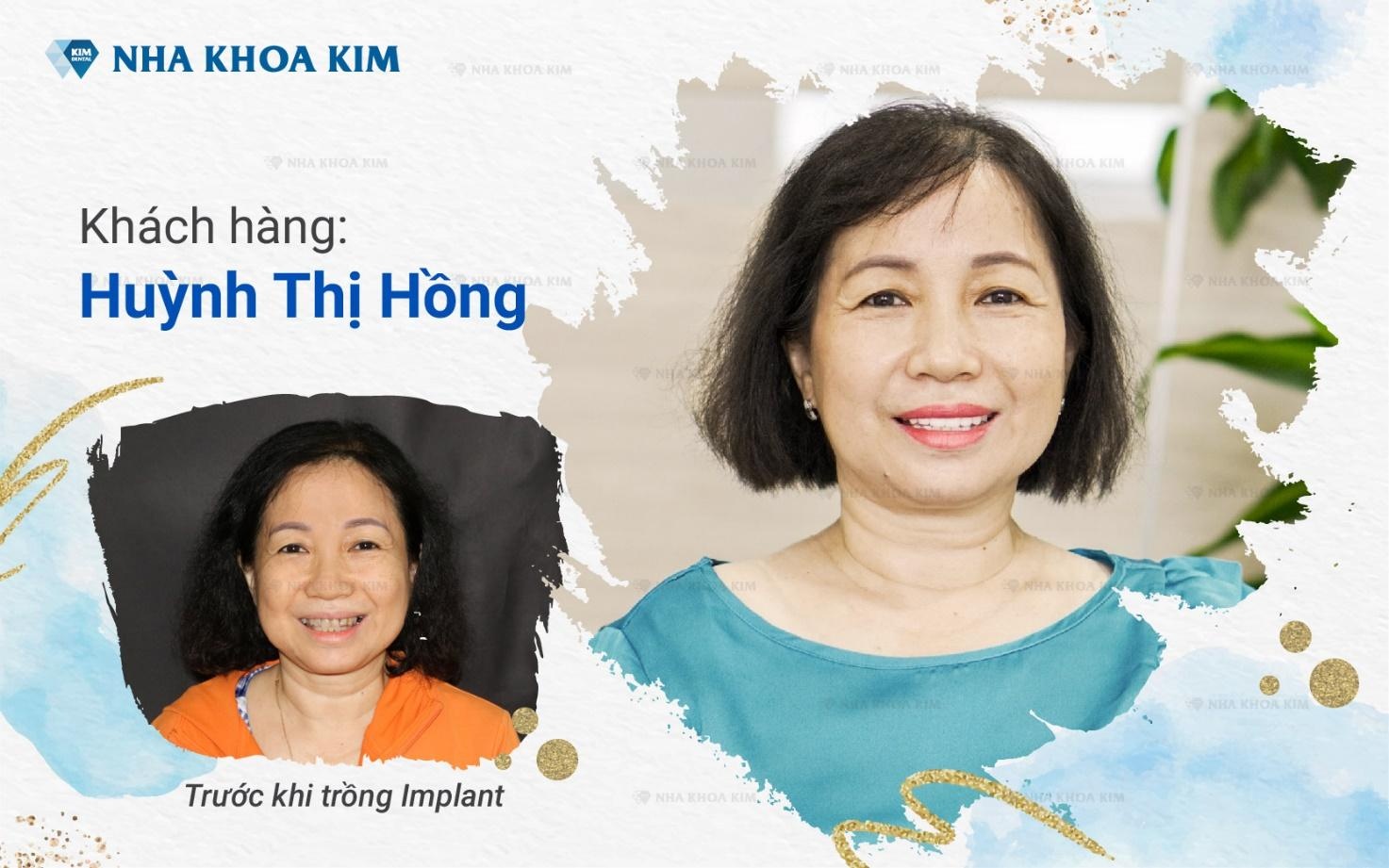 phuc hinh rang tham my anh 2