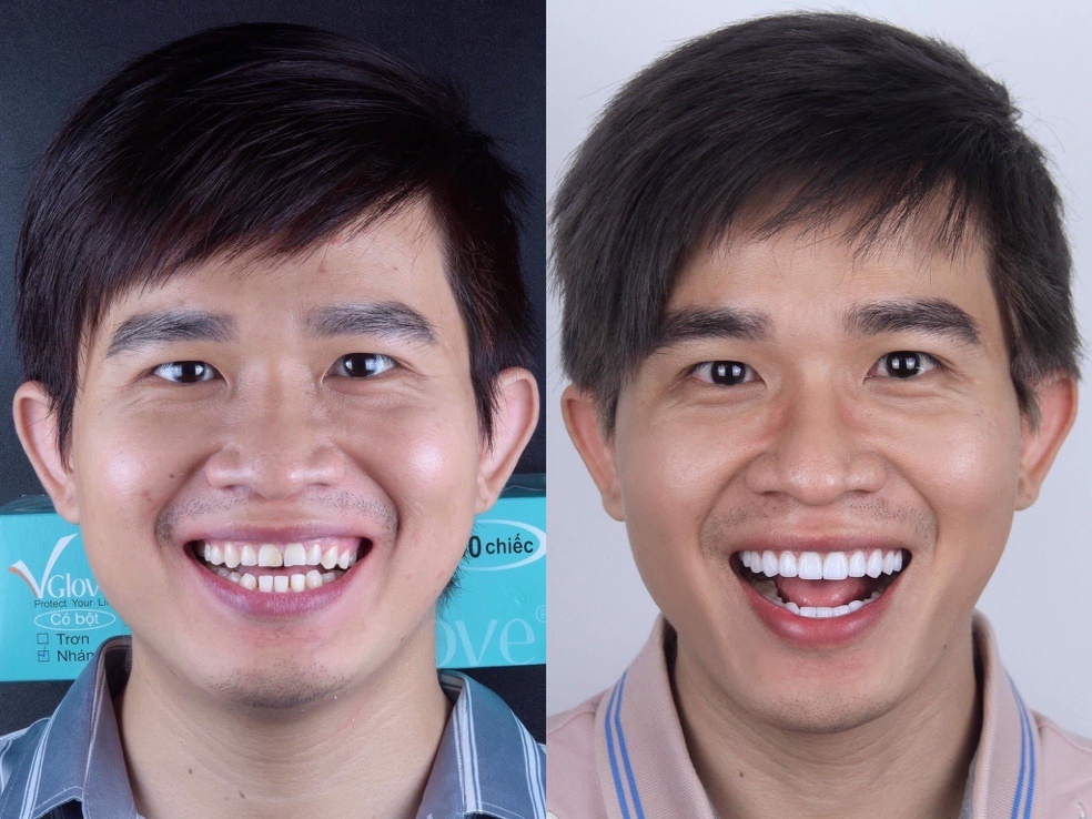 Dr Tony Dental anh 4