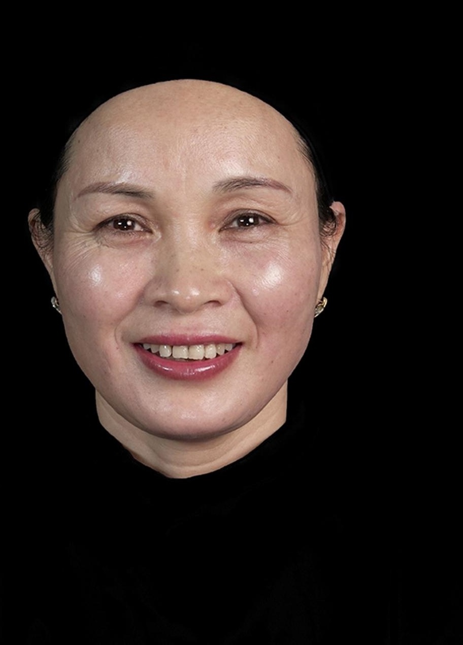 Filler MD Dynamic Codes ảnh 2 Filler MD Dynamic Codes anh 2