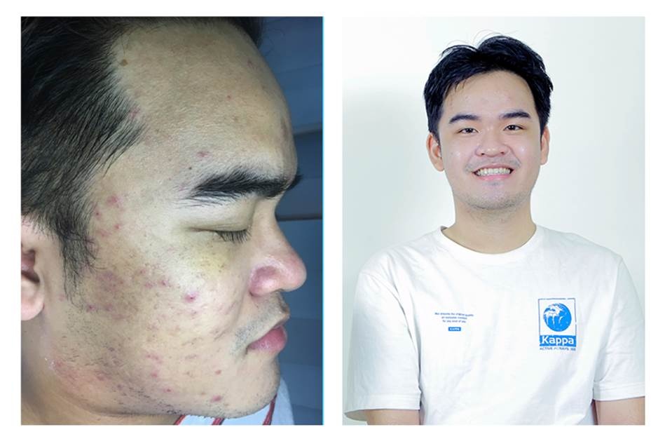 cham soc da mun anh 2