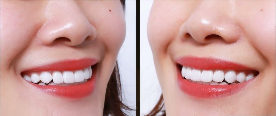 Nha khoa Viet Han 04 anh 3