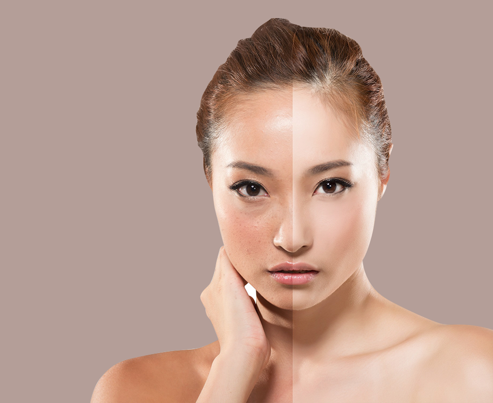 công dụng của melanin ảnh 2 cong dung cua melanin anh 2