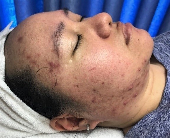 O2 Skin ảnh 1 O2 Skin anh 1