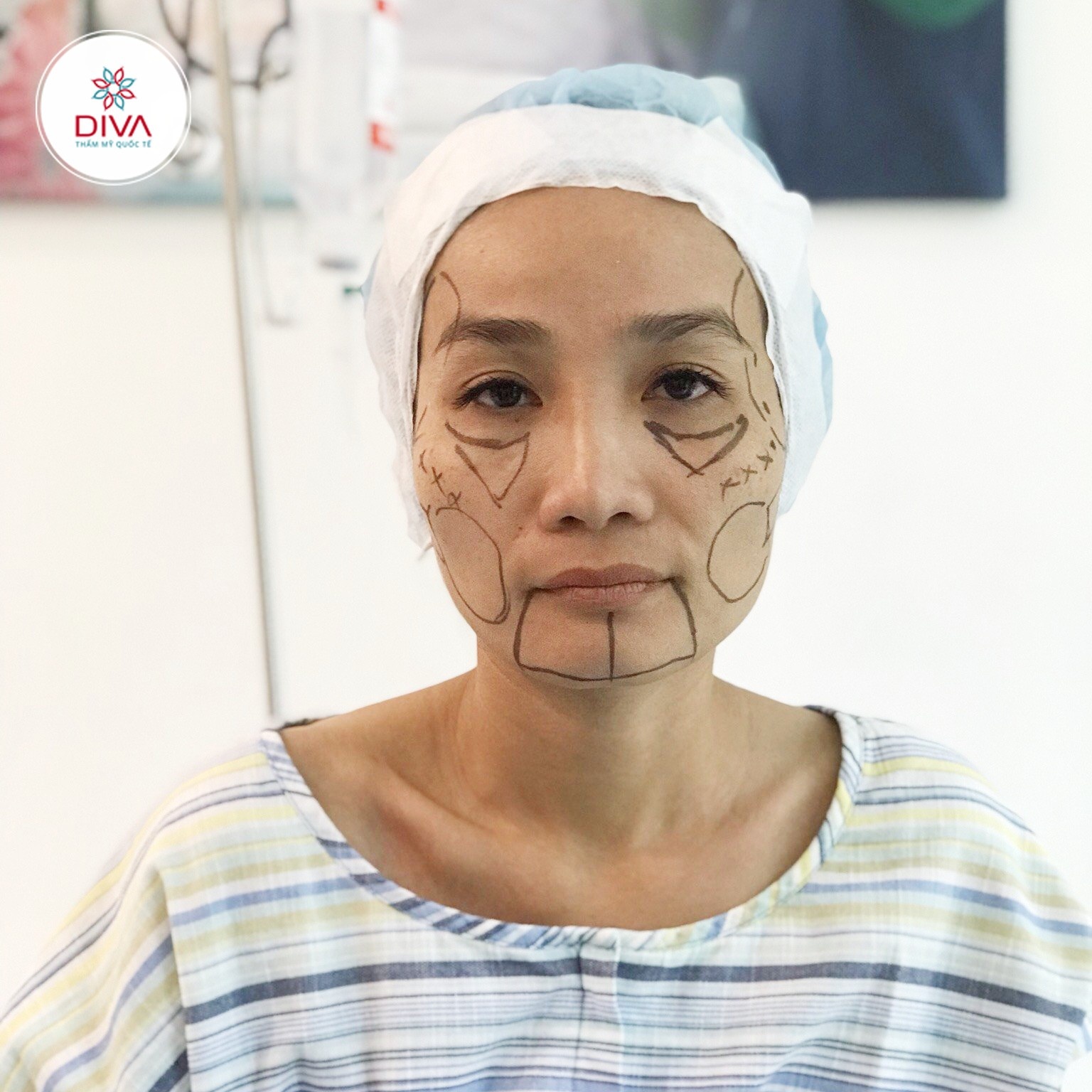 Tham my Quoc te Diva anh 1