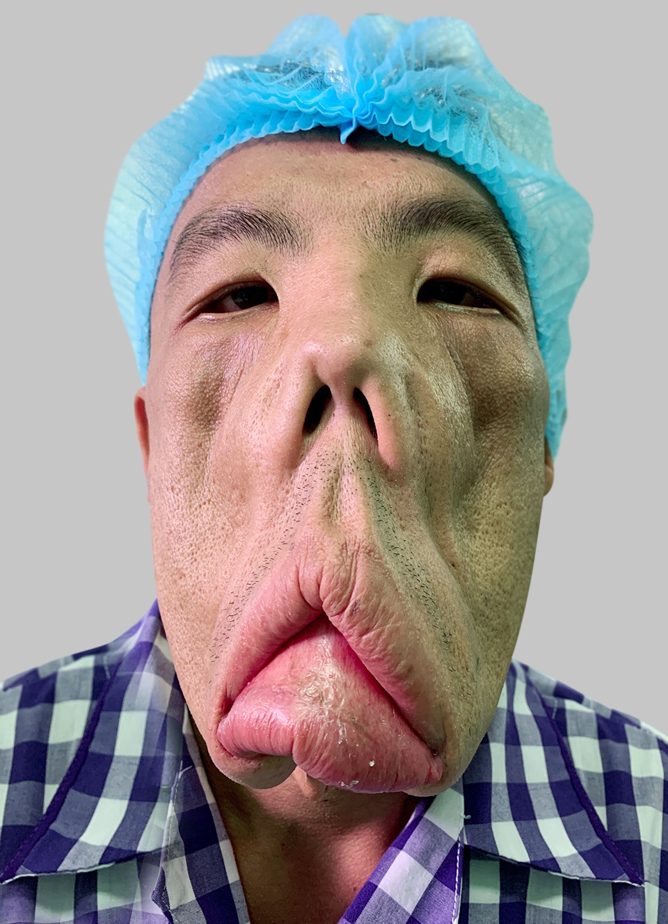 benh vien tham my JW anh 2