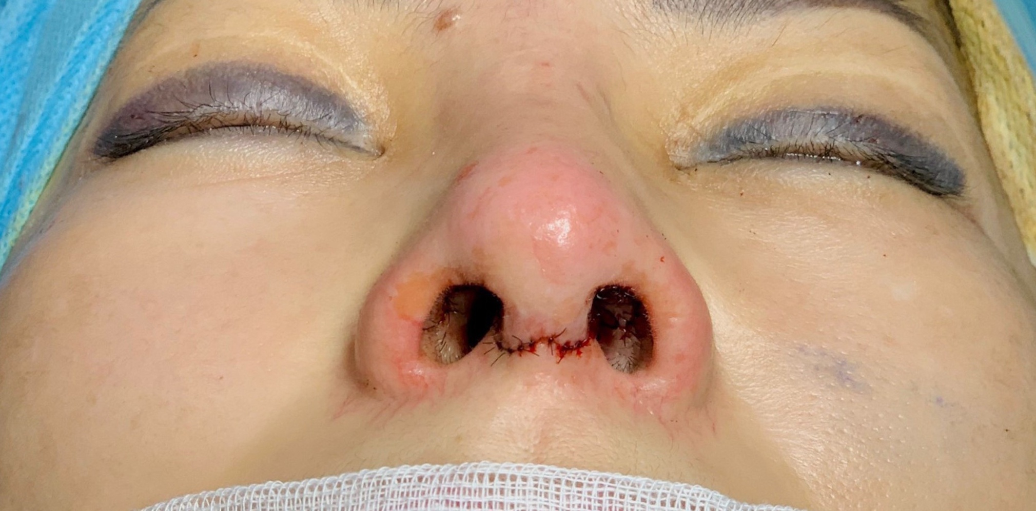 Tham my quoc te Diva anh 4