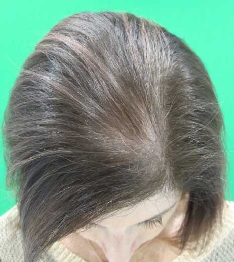 Hush & Hush ảnh 4 Hush & Hush anh 4