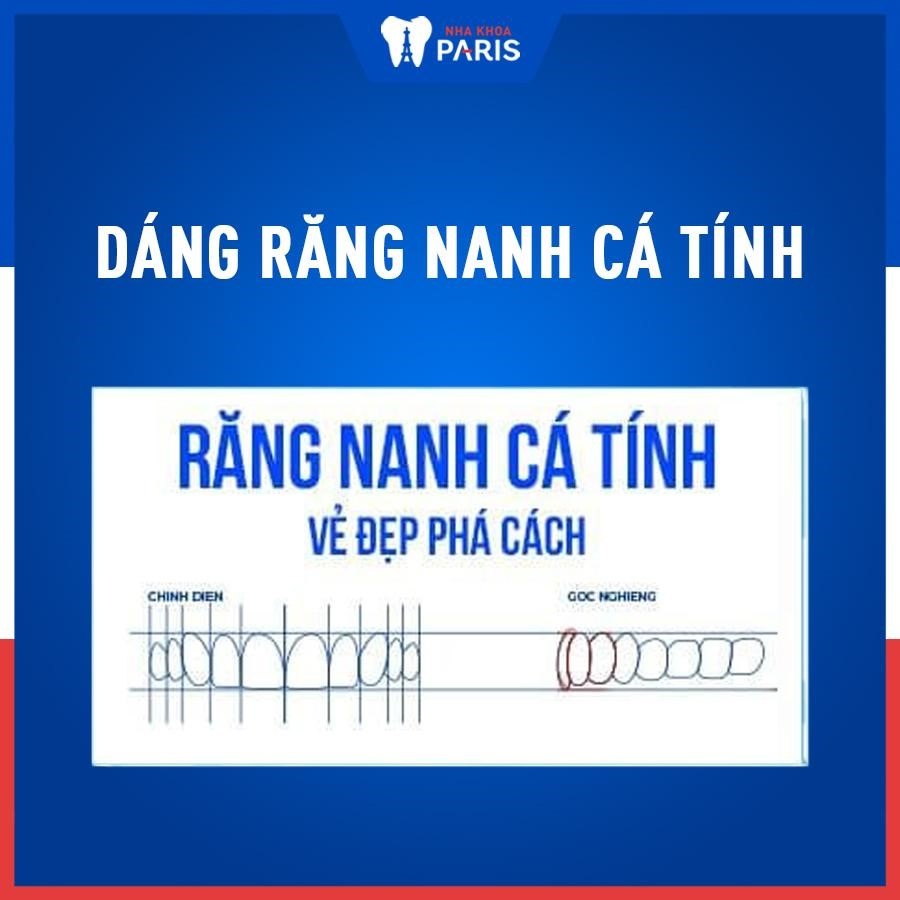 Nha khoa Paris anh 4