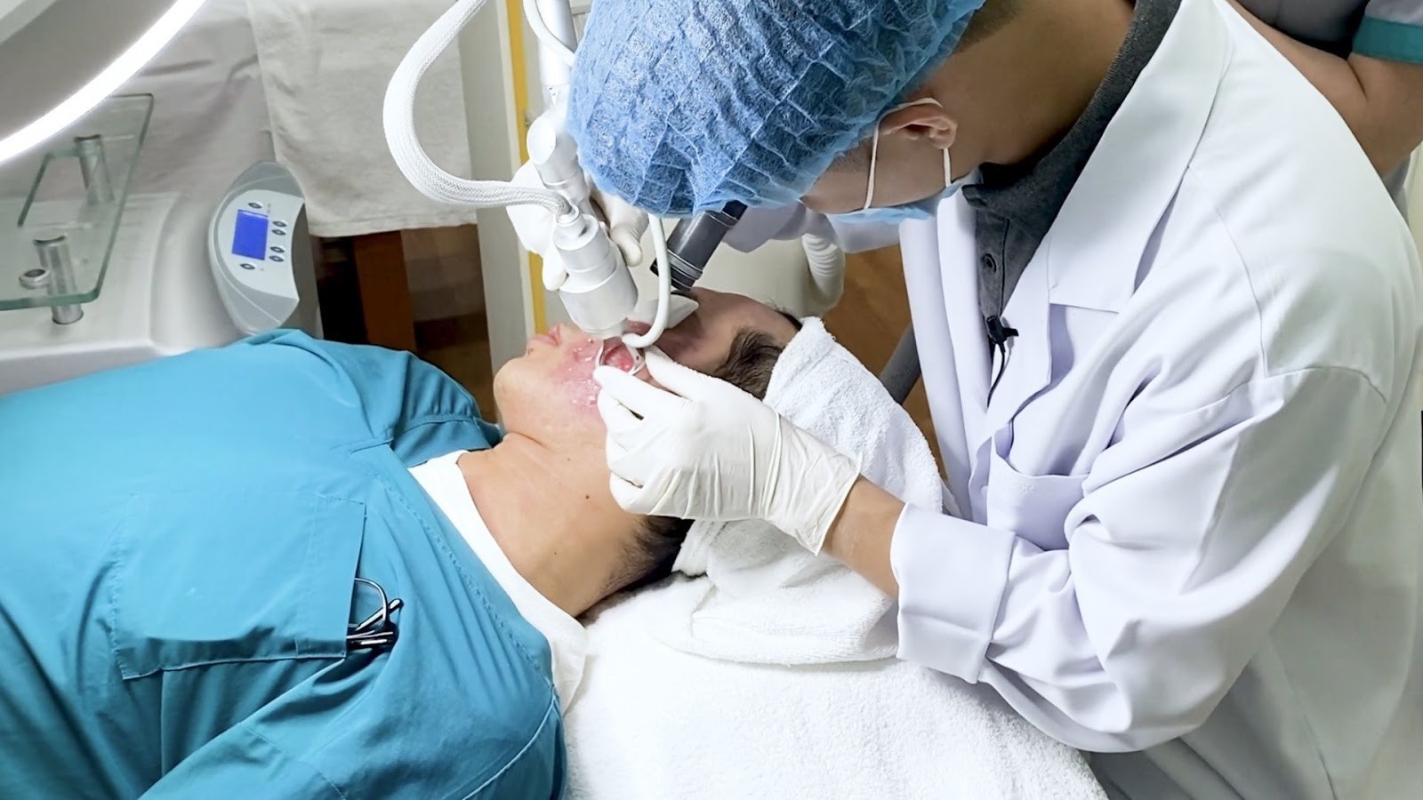 Hanh trinh thay doi dien mao cua chang trai bi seo ro lau nam hinh anh