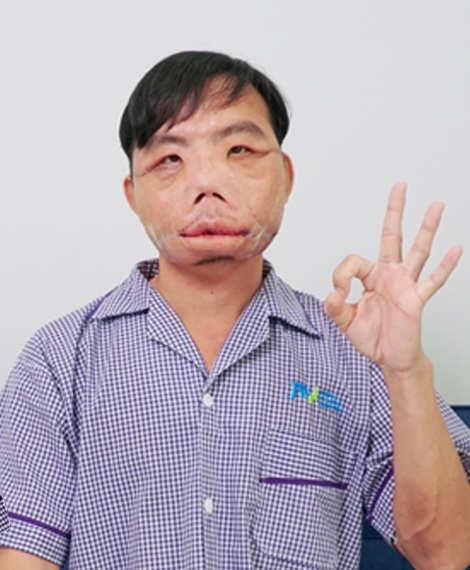 Bệnh viện Thẩm mỹ JW Hàn Quốc ảnh 5 Benh vien Tham my JW Han Quoc anh 5