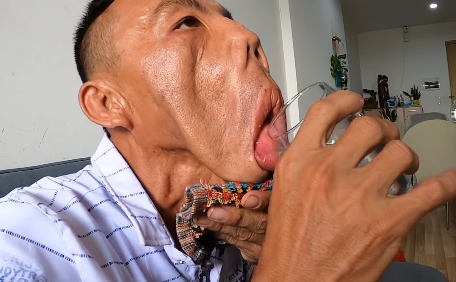 Benh vien Tham my JW Han Quoc anh 2