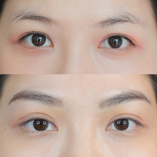 Change Kim Brows anh 1