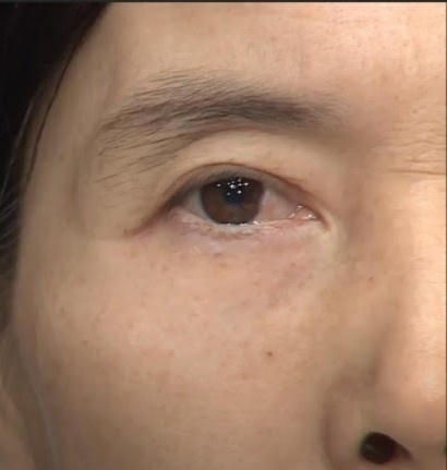 90s Wrinkle Removal Treatment Serum ảnh 5 90s Wrinkle Removal Treatment Serum anh 5