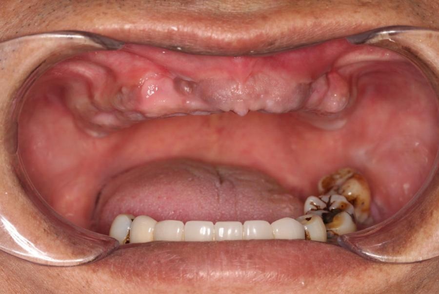 nha khoa I-Dent anh 1