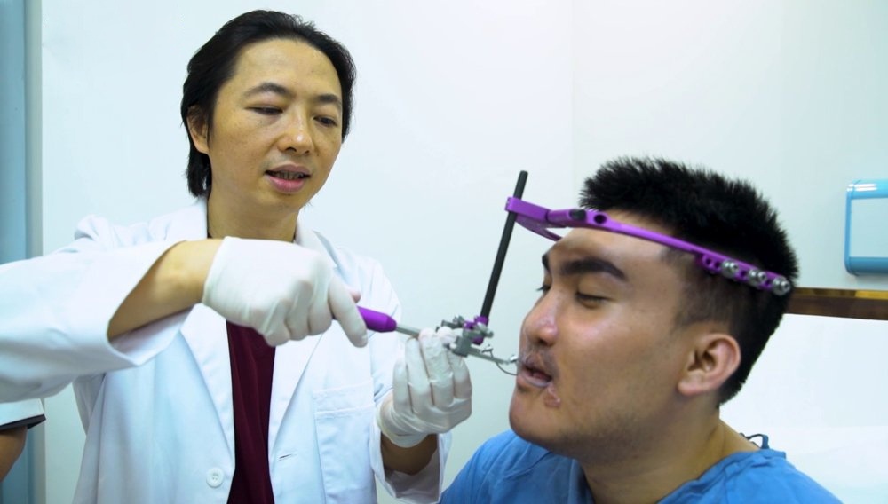 Benh vien tham my Kangnam anh 15