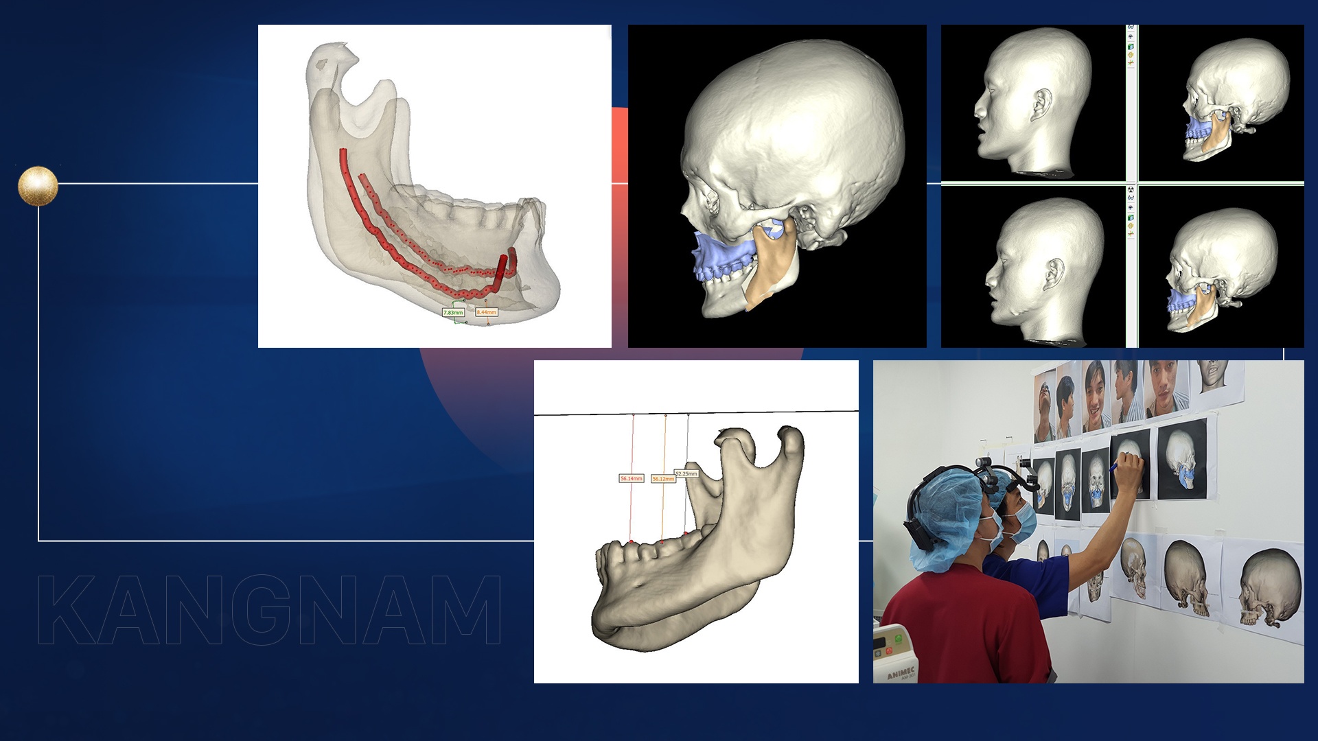 Benh vien tham my Kangnam anh 8
