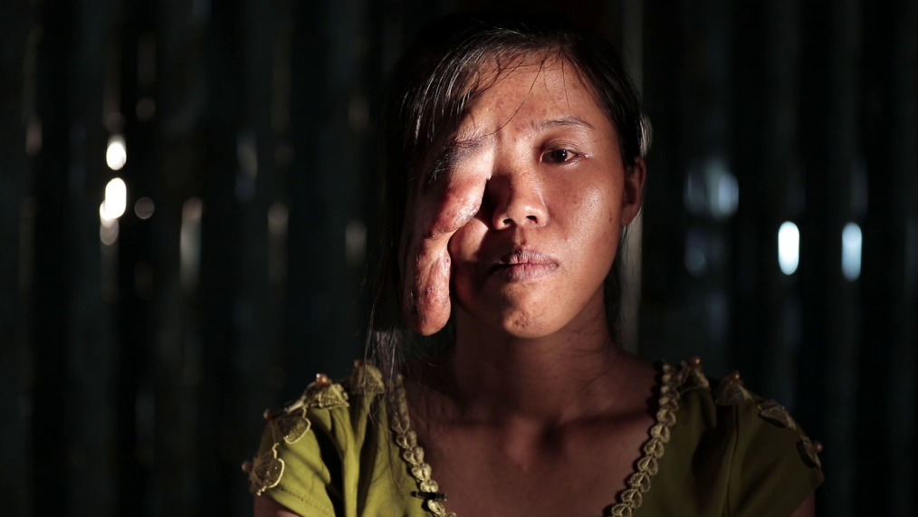 Benh vien tham my Kangnam anh 1