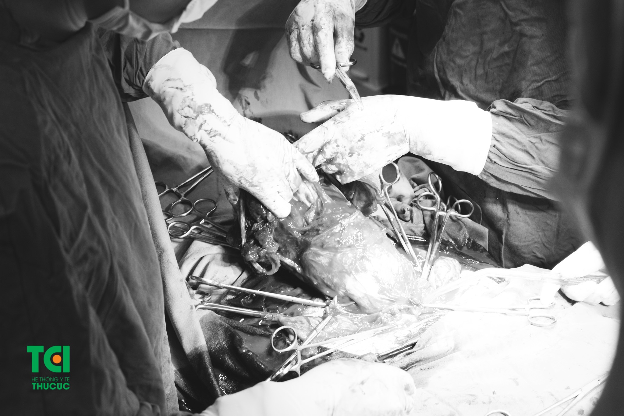 Benh vien DKQT Thu Cuc anh 2