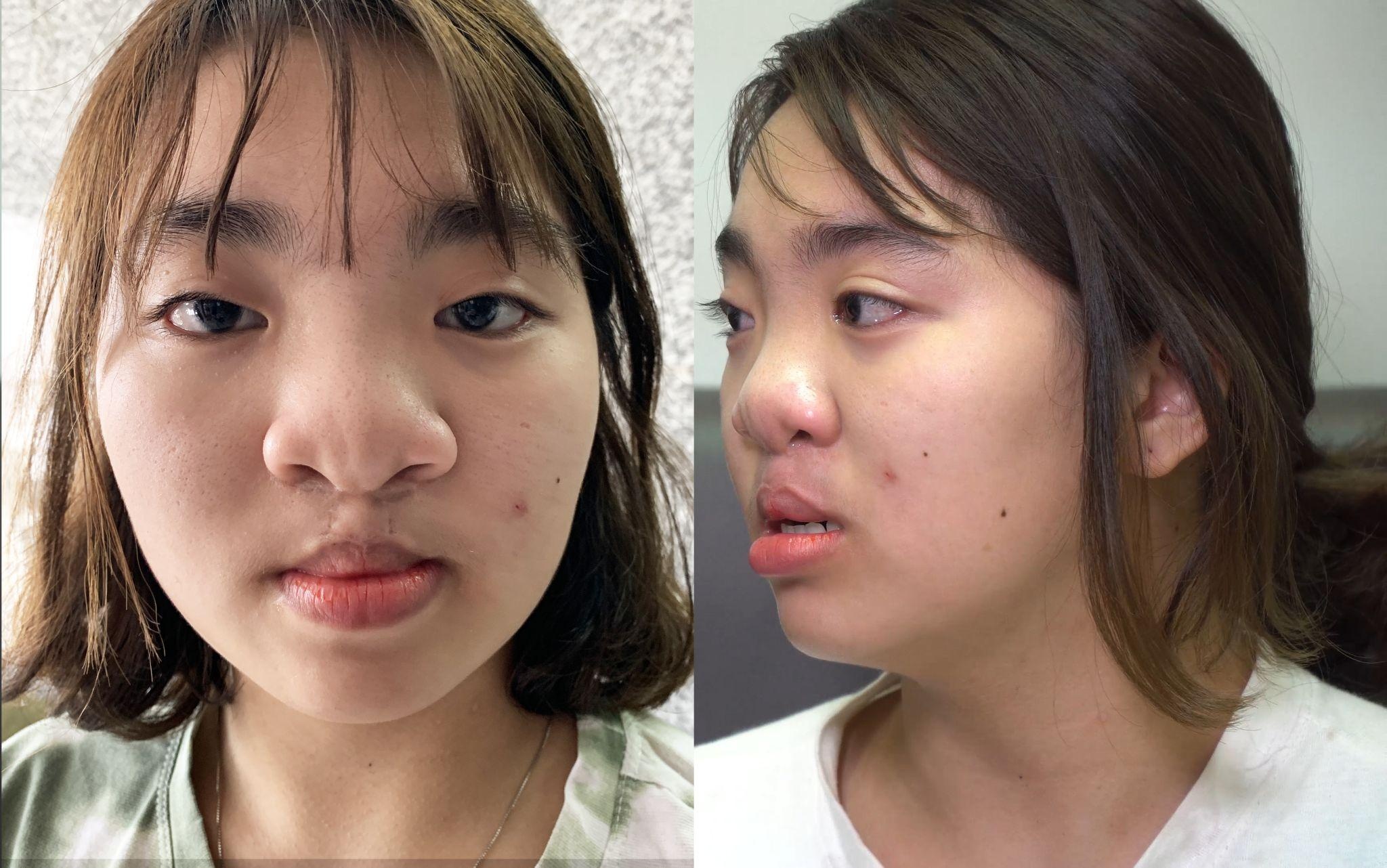 phẫu thuât thẩm mỹ,  tìm lại nụ cười ảnh 1 phau thuat tham my,  tim lai nu cuoi anh 1