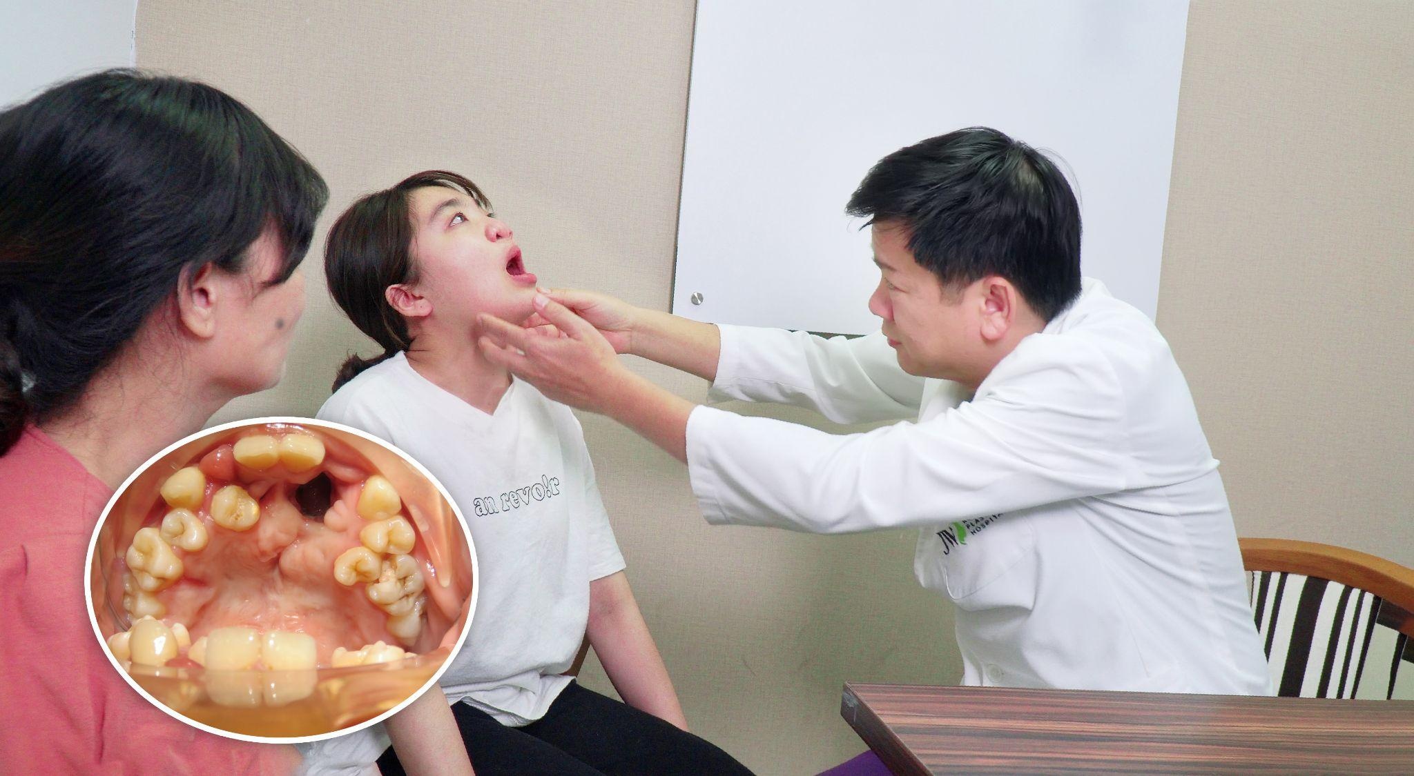 phẫu thuât thẩm mỹ,  tìm lại nụ cười ảnh 3 phau thuat tham my,  tim lai nu cuoi anh 3