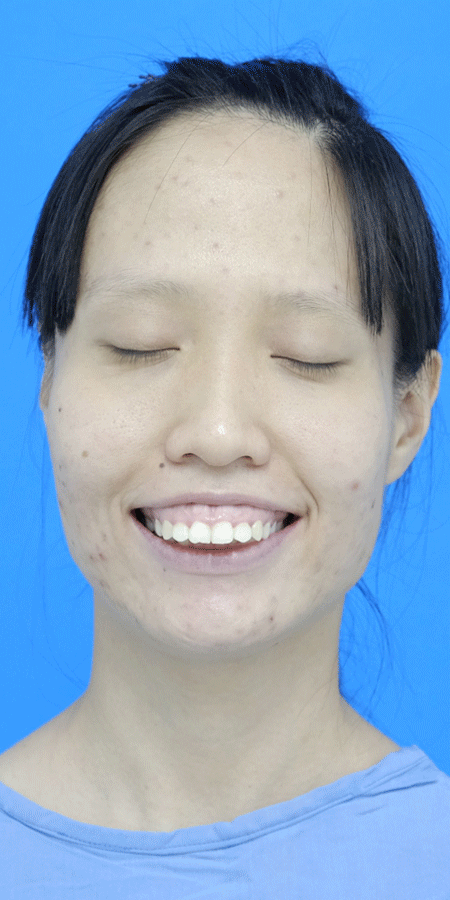 Hanh trinh lot xac,  Benh vien tham my Kangnam anh 3