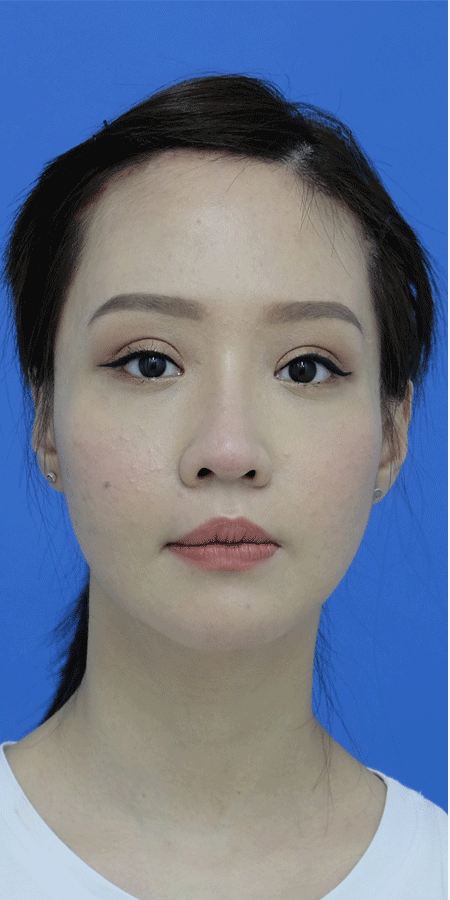 Hanh trinh lot xac,  Benh vien tham my Kangnam anh 4