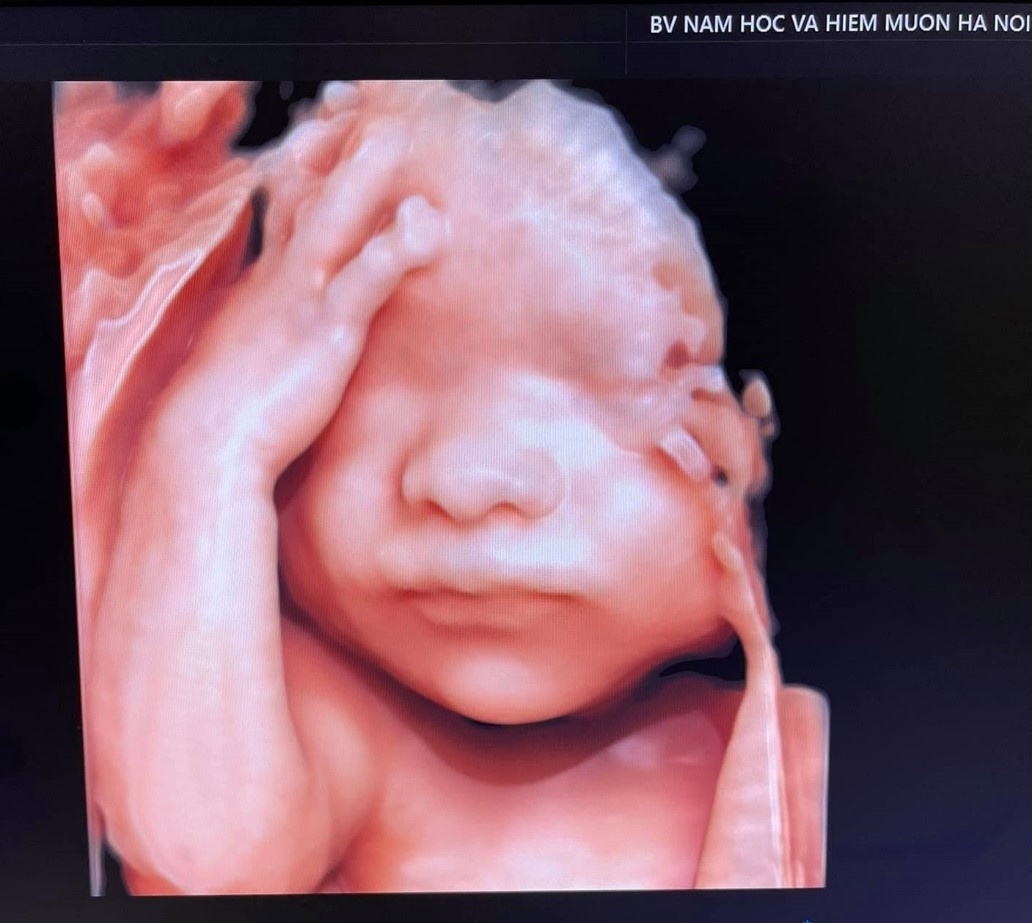 Benh vien Nam hoc va Hiem muon Ha Noi anh 1