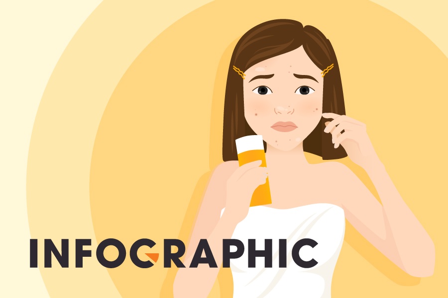 Can luu y gi khi chon kem chong nang kiem dau va ngua mun? hinh anh