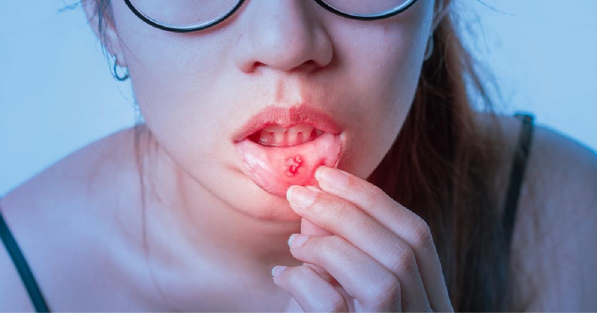 thanh nhiet,  Livecool anh 1