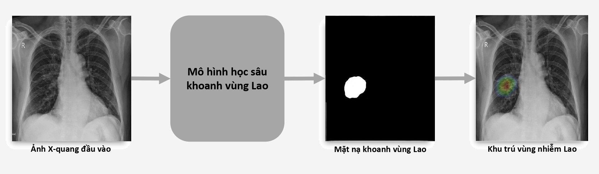 VinBrain anh 2