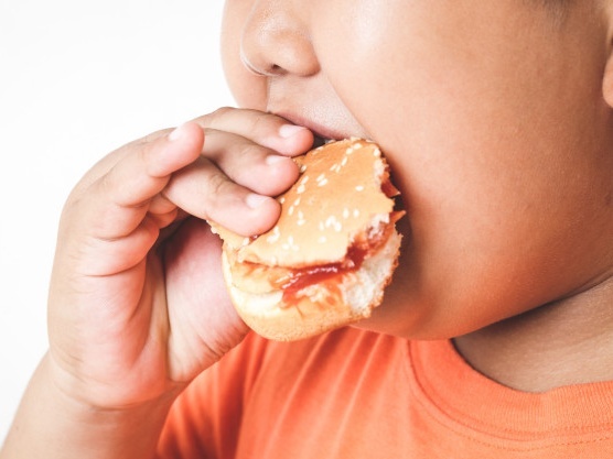 Cu 4 trong 10 hoc sinh tieu hoc thanh thi bi thua can, beo phi hinh anh