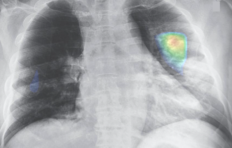 San pham tri tue nhan tao cua VinBrain dat giai ACM SIGAI 2021 hinh anh