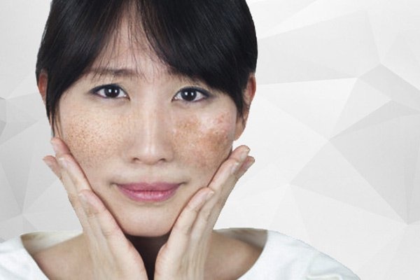 Nguyen nhan gay sam da va cach khac phuc hinh anh