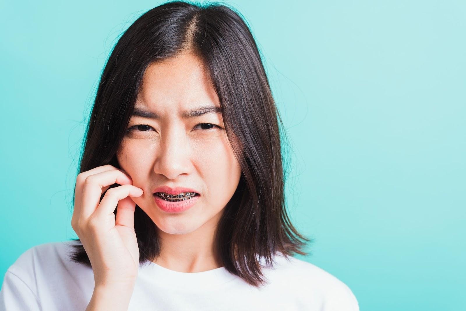 chăm sóc răng,  điều chỉnh răng ảnh 1 cham soc rang,  dieu chinh rang anh 1