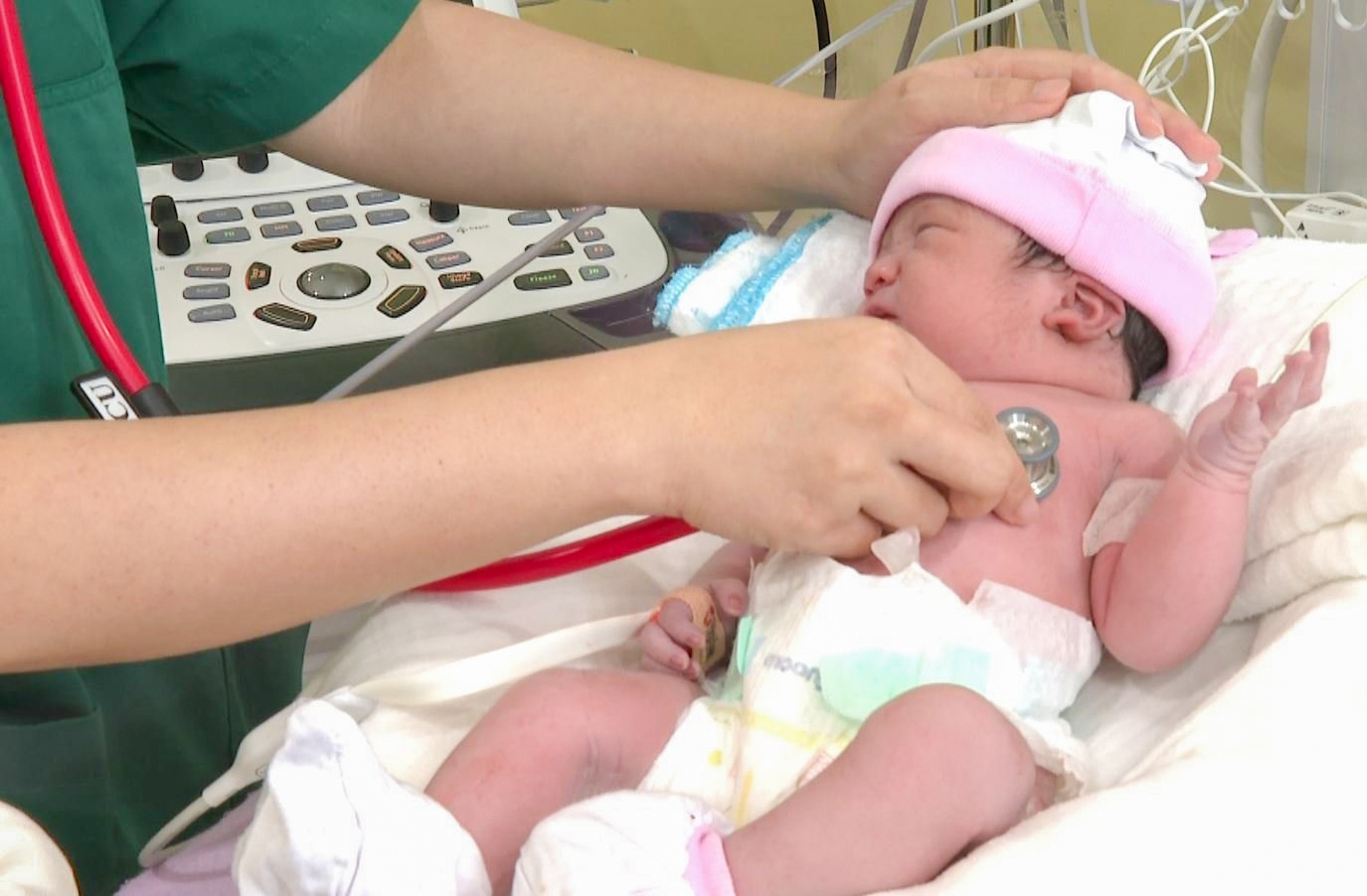 Hanh trinh cuu song thai nhi tim bam sinh phuc tap hinh anh