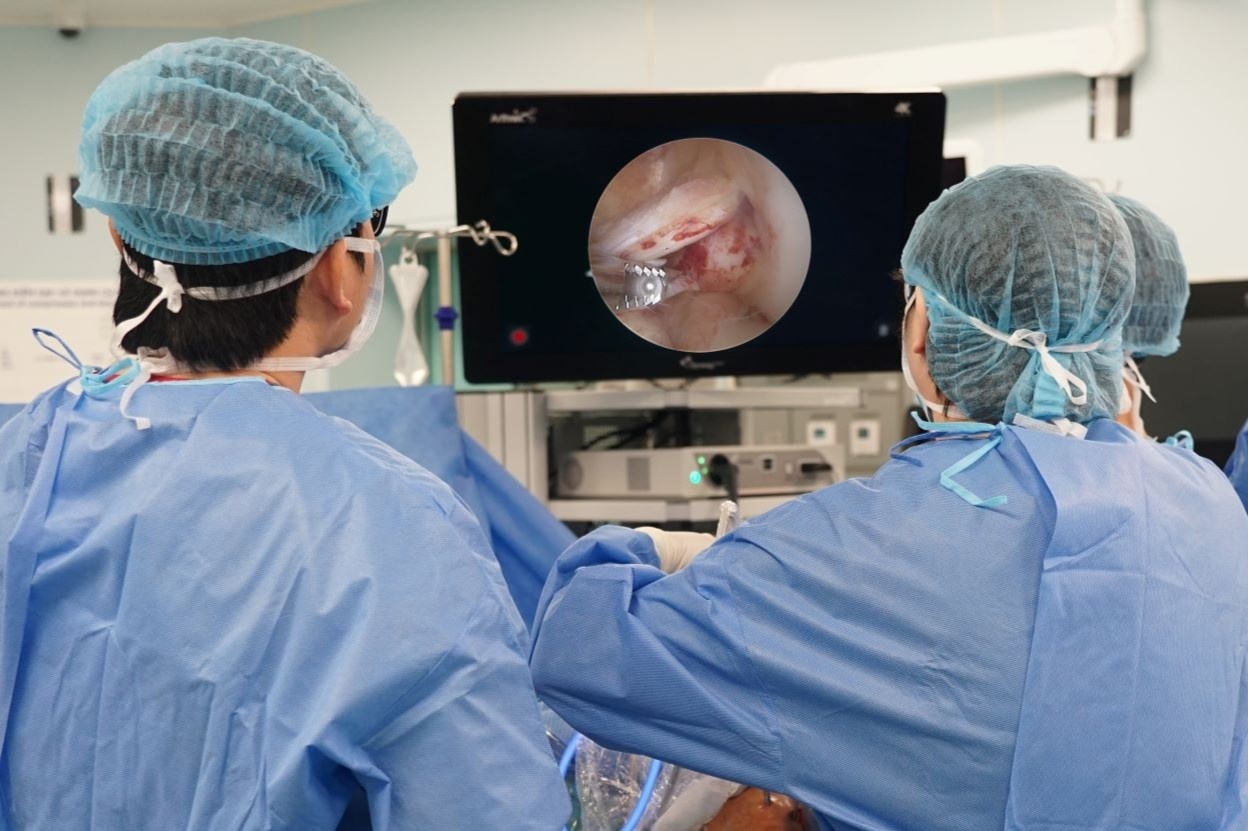 Vinmec tai tao day chang cheo truoc khop goi nho phuong phap doc quyen hinh anh