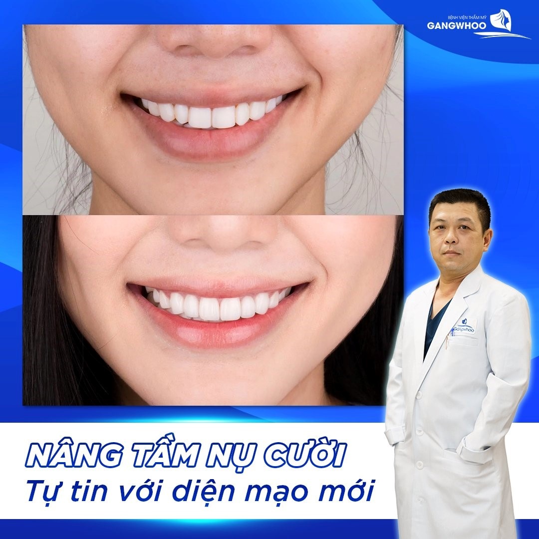 Benh vien tham my Gangwhoo anh 1