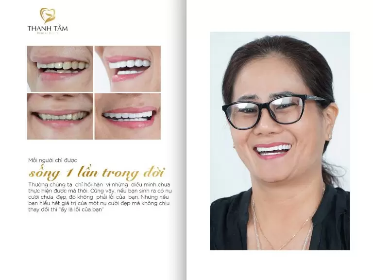 he thong nha khoa Thanh Tam anh 4