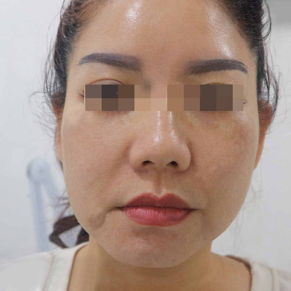 cong nghe titan vang,  CC Clinic anh 3