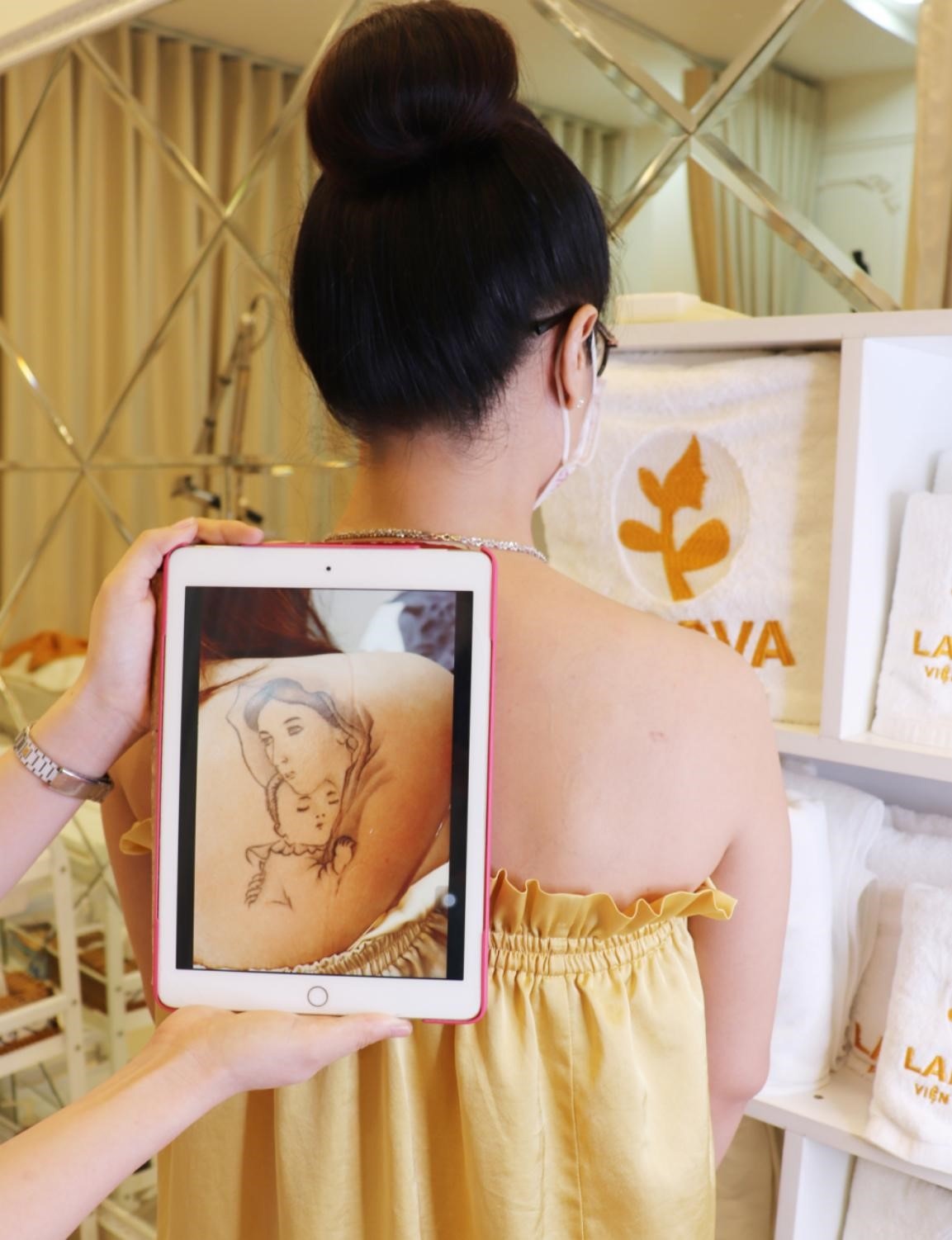 Địa chỉ xóa xăm ảnh 4 Dia chi xoa xam anh 4