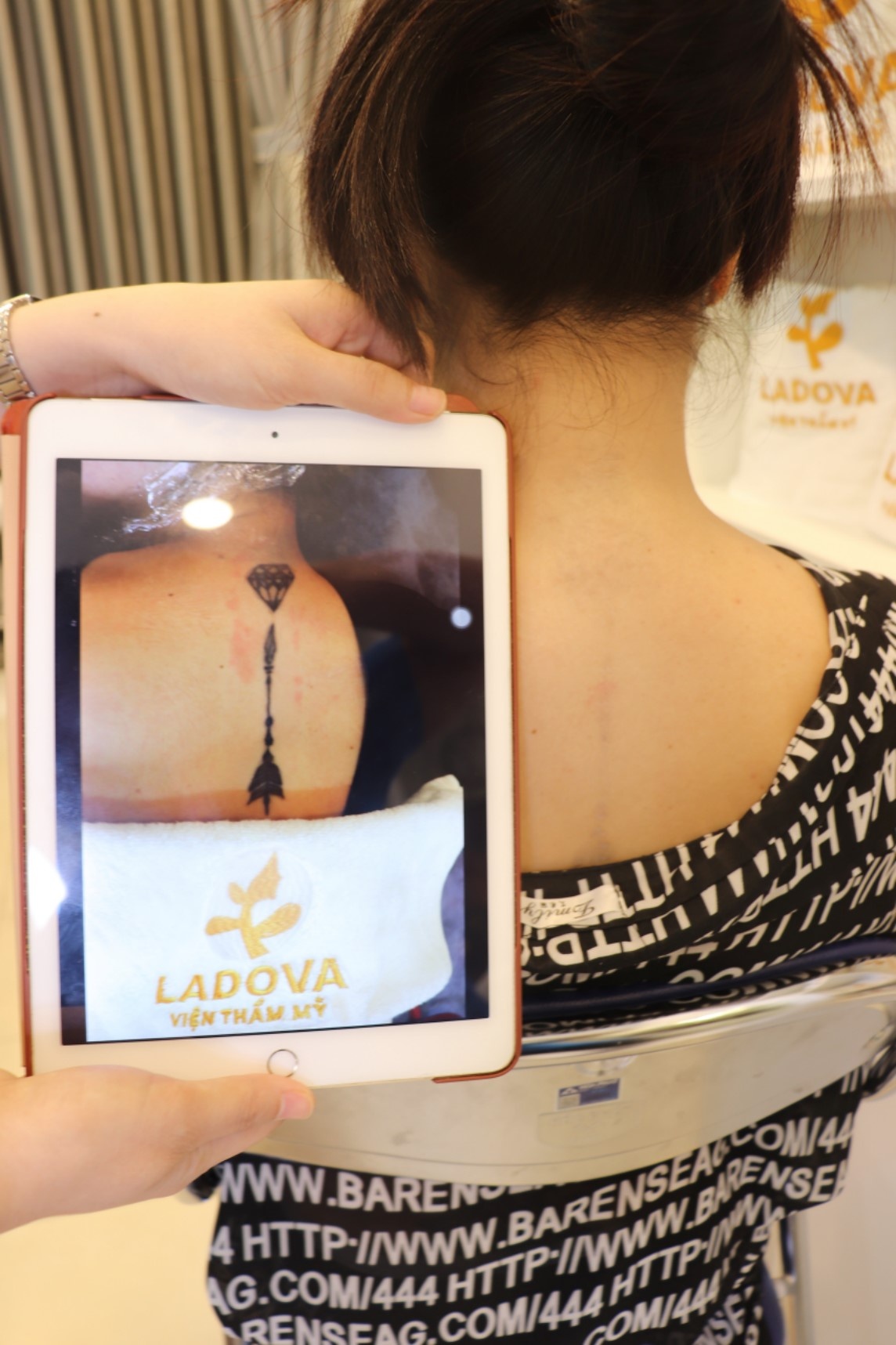 Địa chỉ xóa xăm ảnh 5 Dia chi xoa xam anh 5